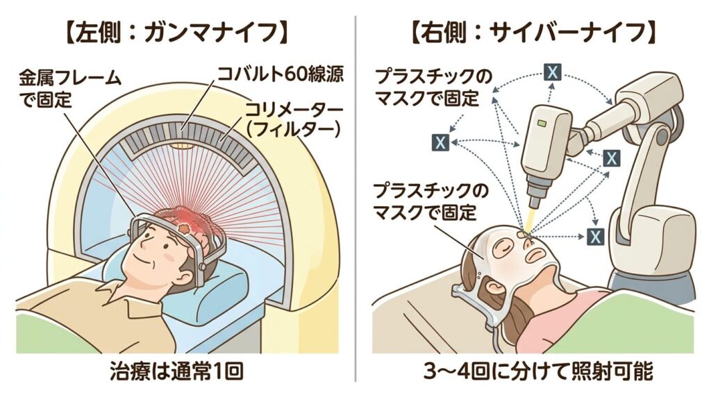 ガンマナイフとサイバーナイフの比較イラスト:左側はガンマナイフのドーム型装置と金属フレームで固定された患者、右側はサイバーナイフのロボットアームとプラスチックマスクで固定された患者